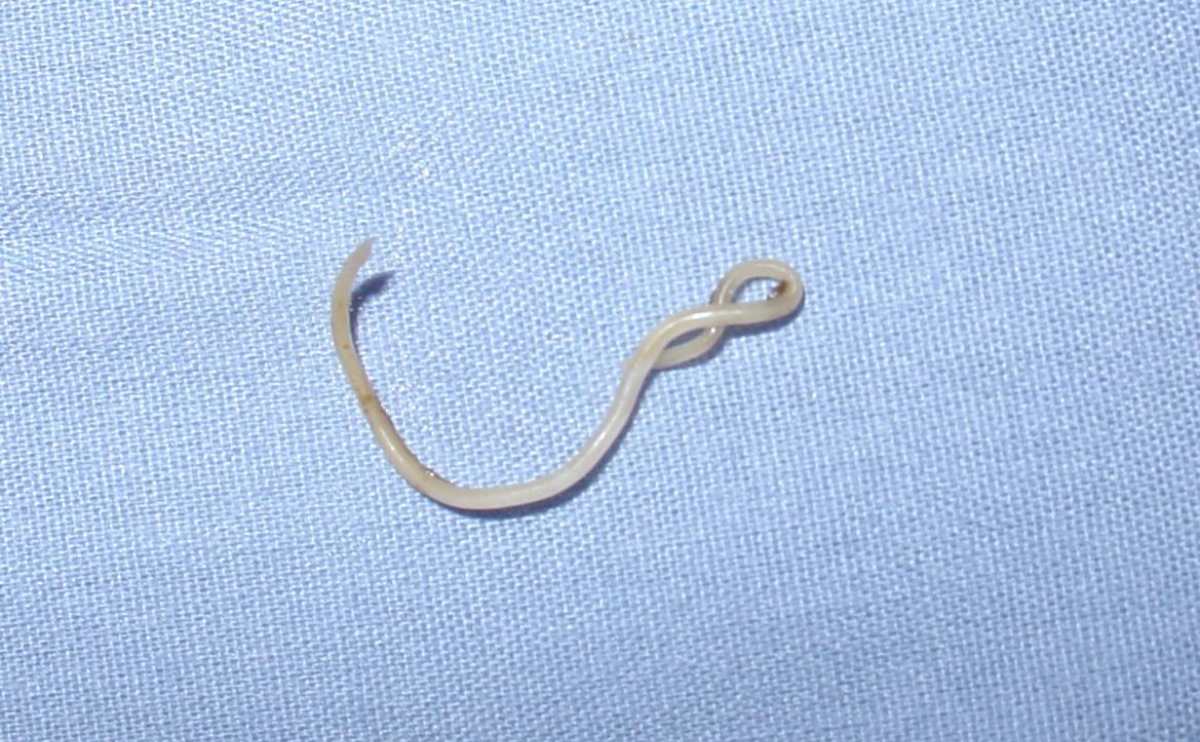 Roundworm up close.